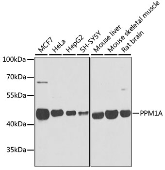 PPM1A Polyclonal Antibody
