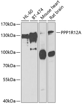 PPP1R12A Polyclonal Antibody