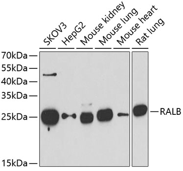 RALB Polyclonal Antibody