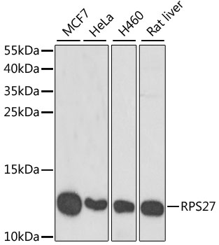 RPS27 Polyclonal Antibody