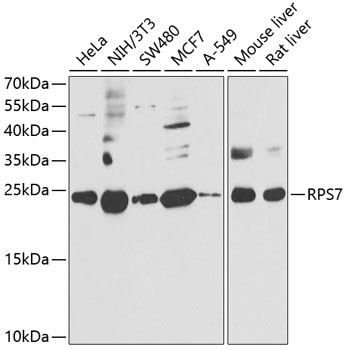 RPS7 Polyclonal Antibody