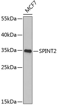 SPINT2 Polyclonal Antibody