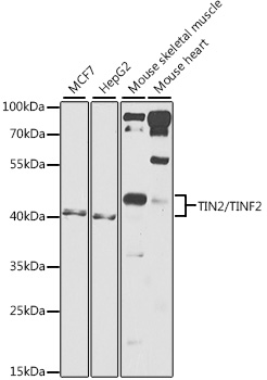TIN2/TINF2 Polyclonal Antibody