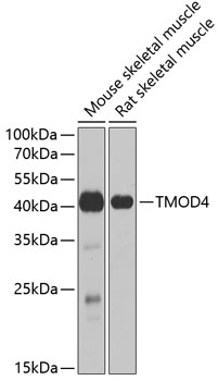 TMOD4 Polyclonal Antibody