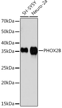 PHOX2B Monoclonal Antibody [4W5J8]