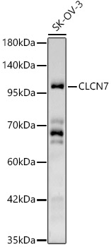 CLCN7 Polyclonal Antibody