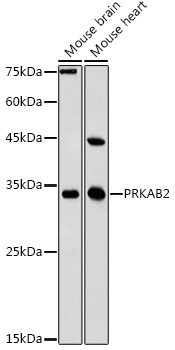 PRKAB2 Polyclonal Antibody