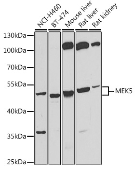 MEK5 Polyclonal Antibody