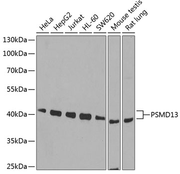 PSMD13 Polyclonal Antibody