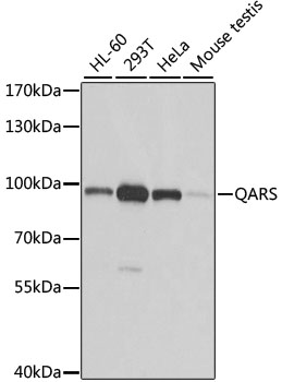 QARS Polyclonal Antibody