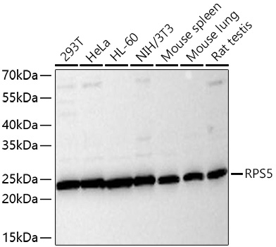 RPS5 Polyclonal Antibody