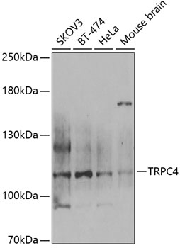 TRPC4 Polyclonal Antibody