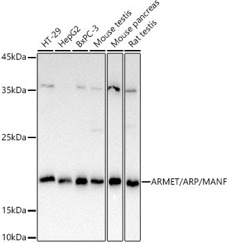 ARMET/ARP/MANF Polyclonal Antibody