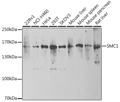 SMC1 Polyclonal Antibody