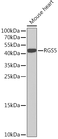 RGS5 Polyclonal Antibody