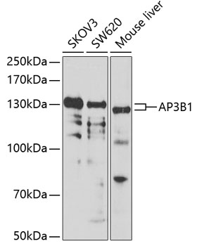 AP3B1 Polyclonal Antibody