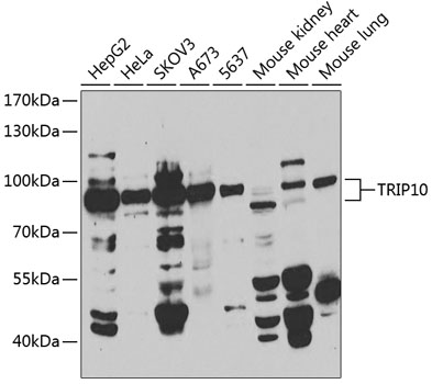 TRIP10 Polyclonal Antibody