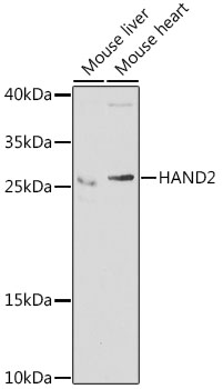 HAND2 Polyclonal Antibody