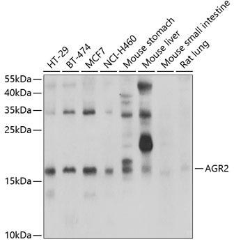 AGR2 Polyclonal Antibody&nbsp;<img src="images/icon_newarrival.gif" alt="new" border="0">