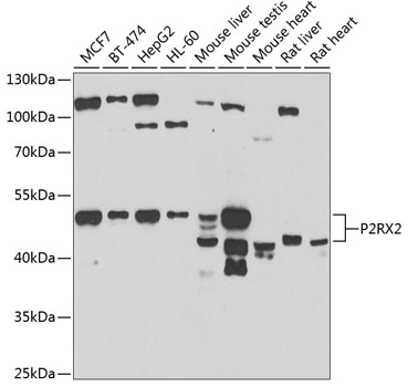 P2RX2 Polyclonal Antibody