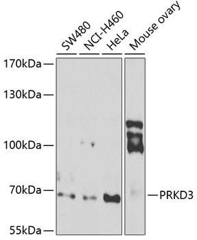 PRKD3 Polyclonal Antibody