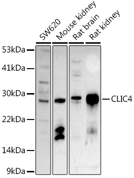 CLIC4 Polyclonal Antibody