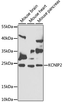 KCNIP2 Polyclonal Antibody