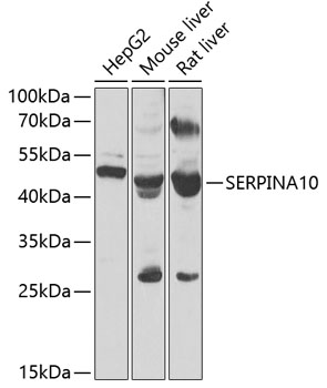 SERPINA10 Polyclonal Antibody