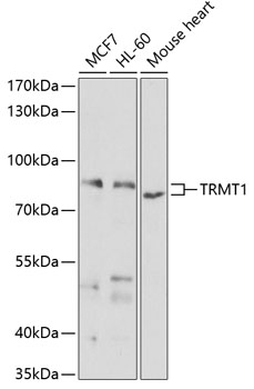 TRMT1 Polyclonal Antibody