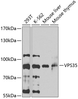 VPS35 Polyclonal Antibody