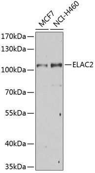ELAC2 Polyclonal Antibody