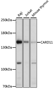 CARD11 Polyclonal Antibody