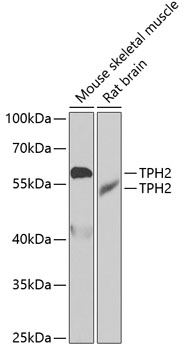 TPH2 Polyclonal Antibody