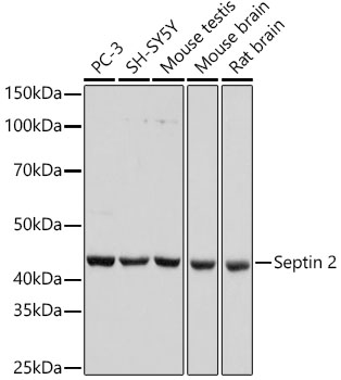 Septin 2 Monoclonal Antibody [9N1B3]