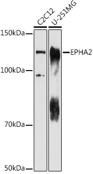EPHA2 Polyclonal Antibody