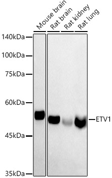 ETV1 Polyclonal Antibody