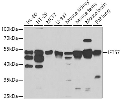 IFT57 Polyclonal Antibody