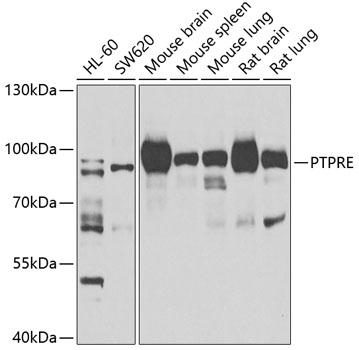 PTPRE Polyclonal Antibody