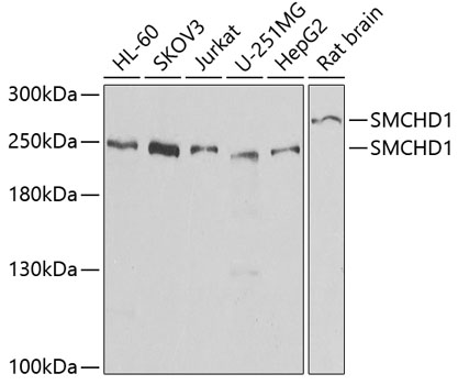 SMCHD1 Polyclonal Antibody