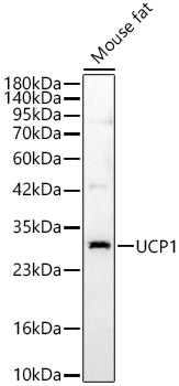 UCP1 Polyclonal Antibody