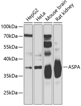 ASPA Polyclonal Antibody