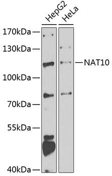 NAT10 Polyclonal Antibody