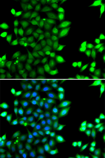 RNF7 Polyclonal Antibody