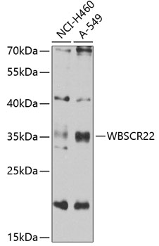 WBSCR22 Polyclonal Antibody