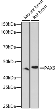PAX6 Polyclonal Antibody