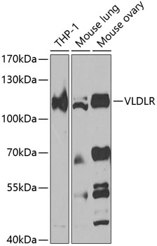 VLDLR Polyclonal Antibody