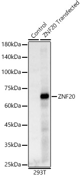 ZNF20 Polyclonal Antibody