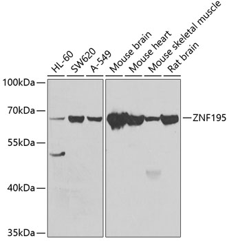 ZNF195 Polyclonal Antibody