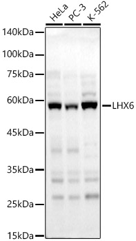 LHX6 Polyclonal Antibody