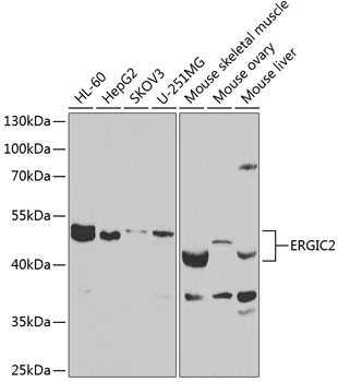 ERGIC2 Polyclonal Antibody